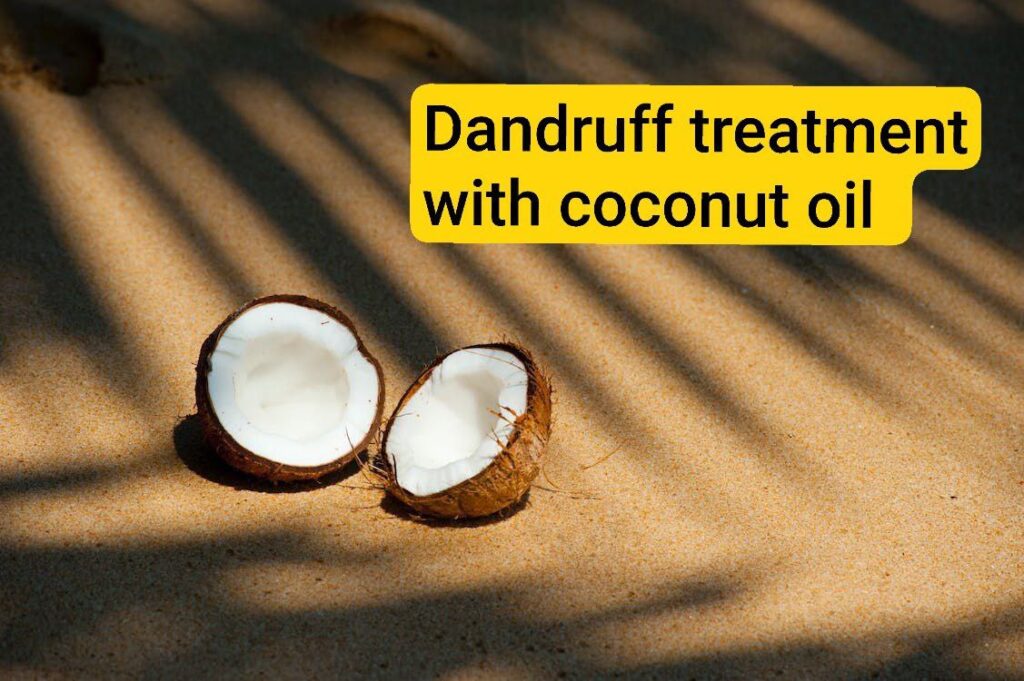 Dandruff treatment with coconut oil