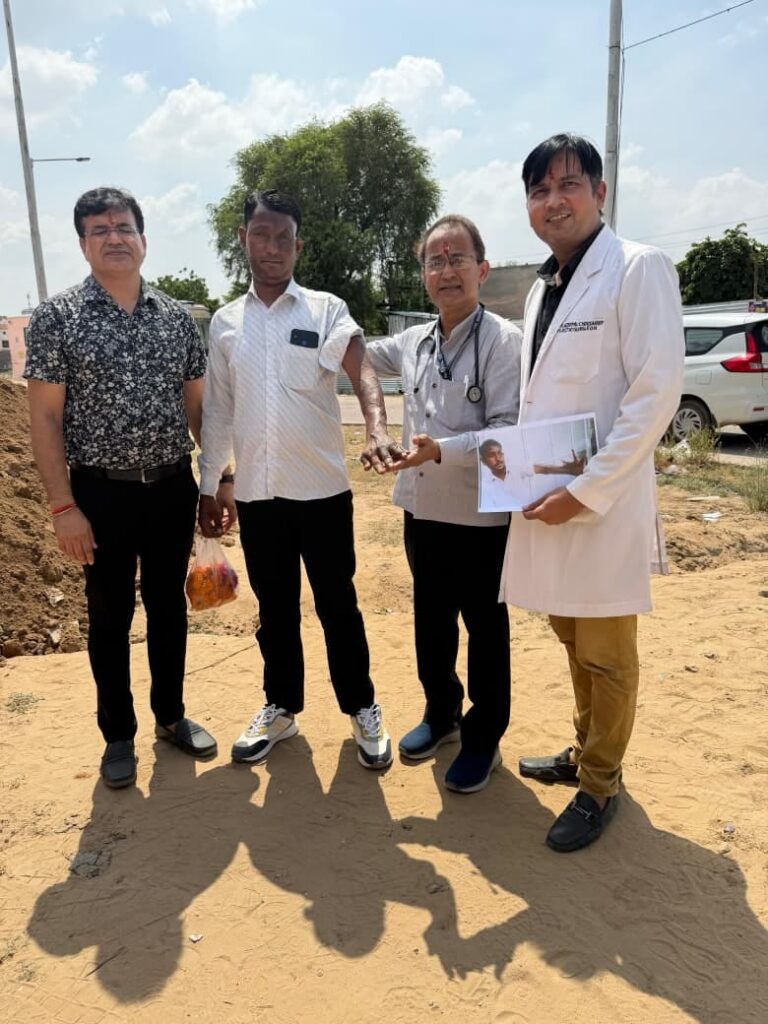 उपलब्धि एसएसबी हॉस्पिटल: 37 साल से झुलसे हाथ के साथ जी रहे बाबूलाल को मिली नई जिंदगी, सर्जरी के बाद अब मजदूरी कर चला रहे परिवार